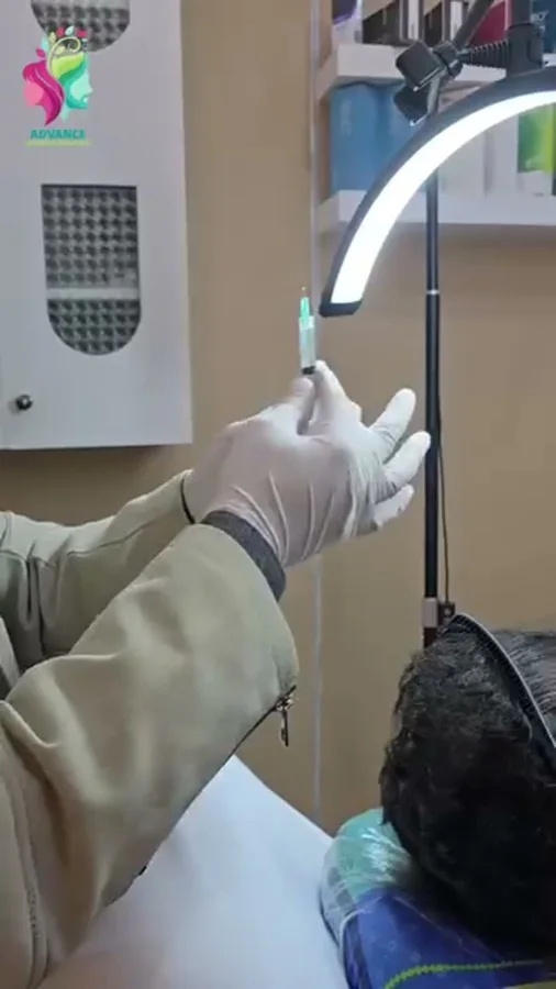Hair fall and hair restoration