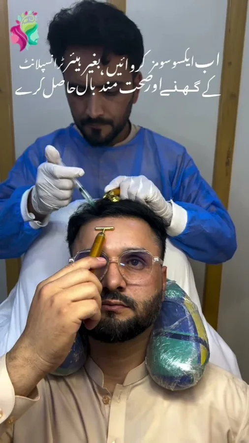 Hair fall and hair restoration