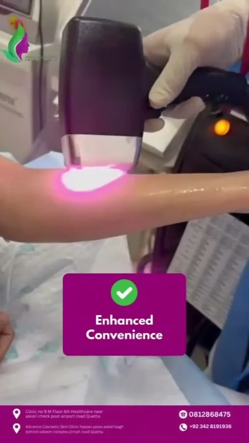 Laser hair removal