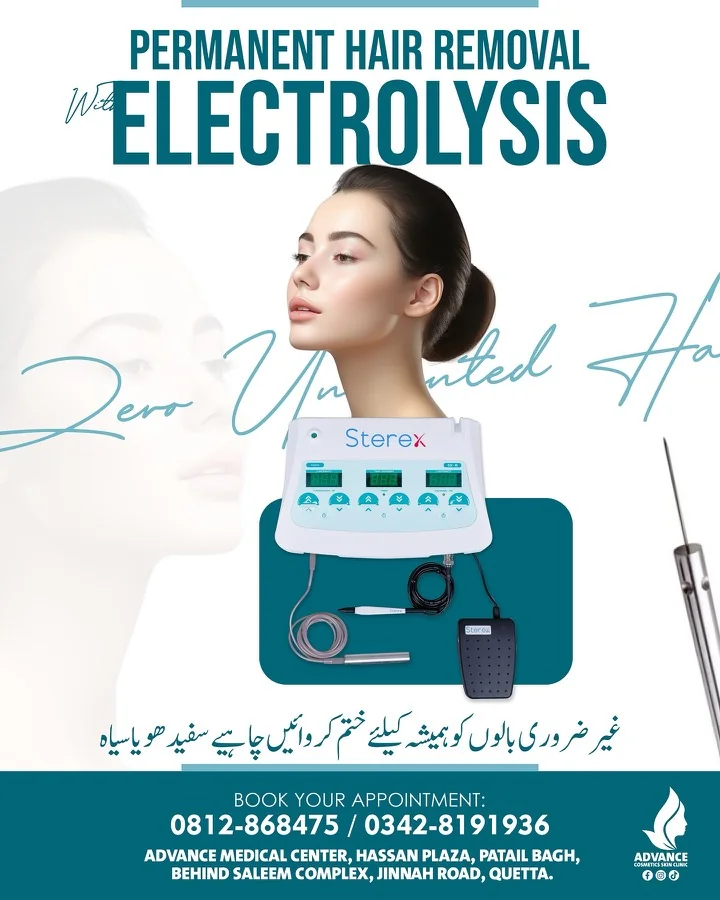 Laser hair removal