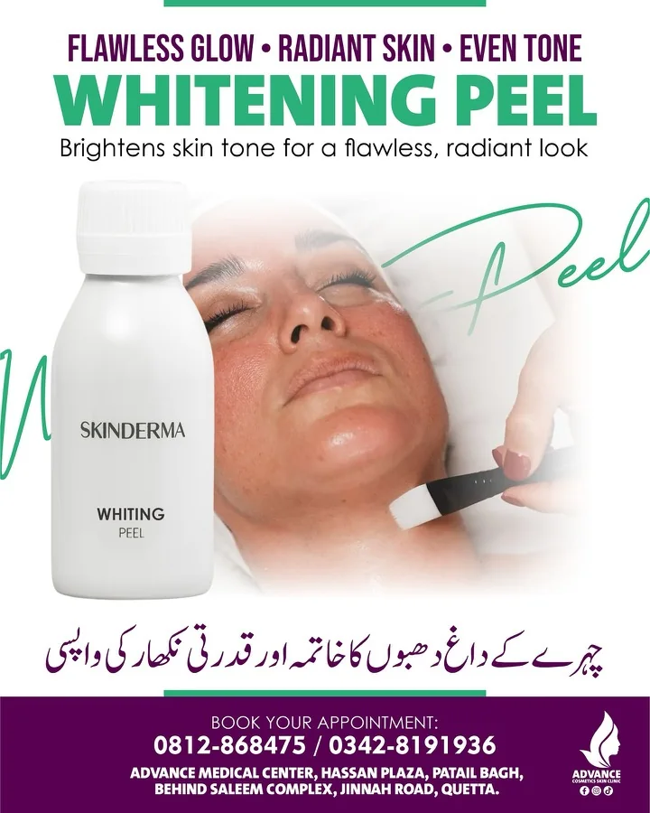 Pigmentation, melasma and freckles